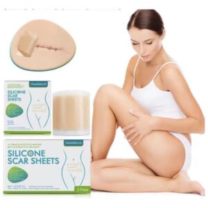 Cinta Parche Eliminación De Cicatrices Rollo De 1.5m X 4cm